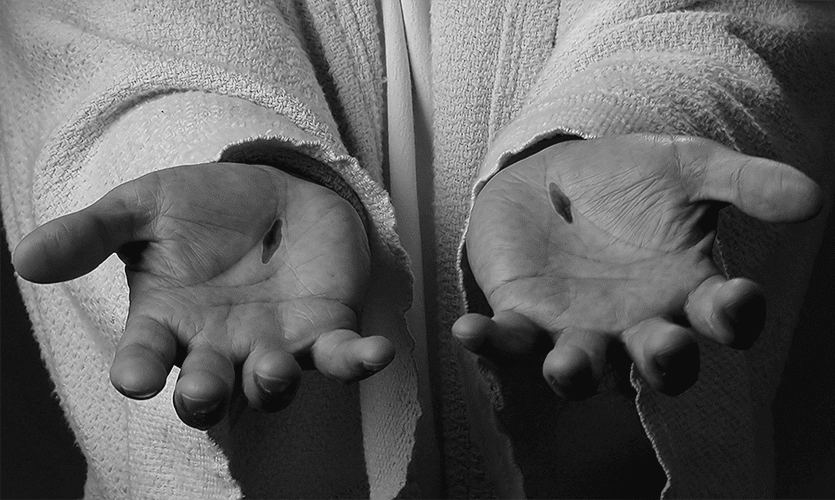 Read more about the article Scars